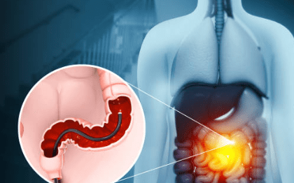 대장내시경 전 음식주의사항