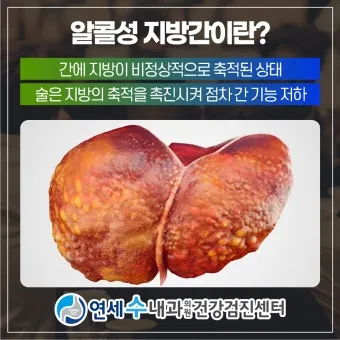 비알콜성 지방간 없애는 방법 운동 식단 중심 회복법 정리_9