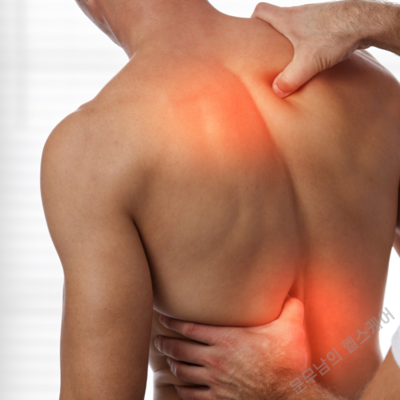 허리 삐끗했을 때&amp;#44; 요추 염좌 치료법