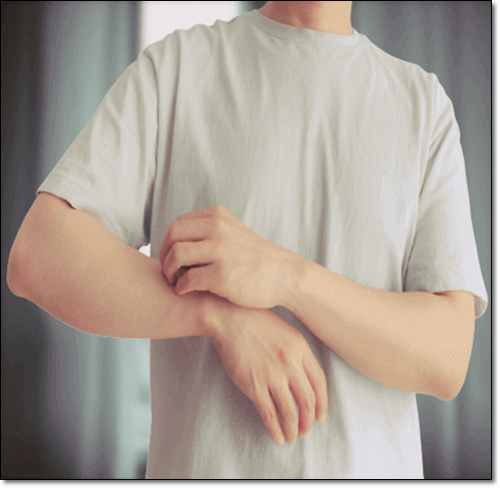 메추이알 항알레르기 효과