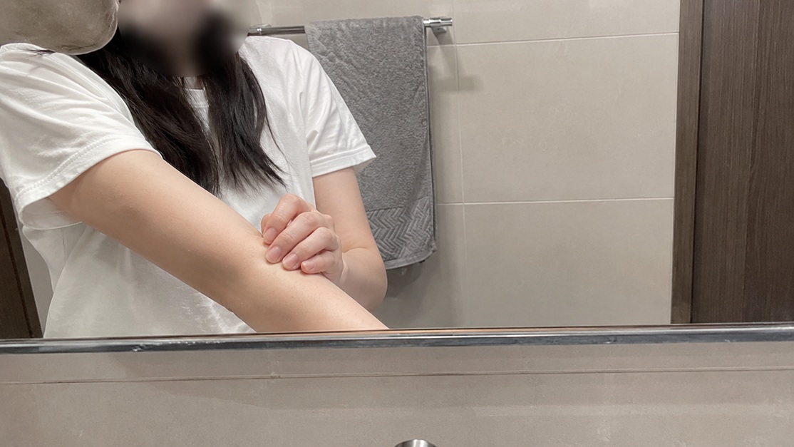 욕실 거울 앞에서 팔 피부를 만지며 모공각화증 관리 후 피부결을 확인하는 실제 후기 사진