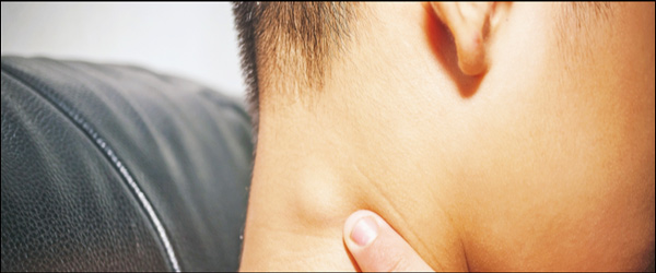 화이자 부작용 임파선염 붓기 이미지