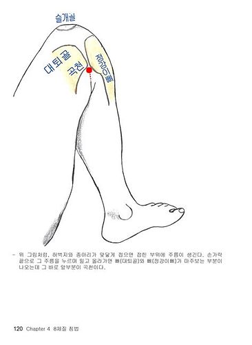 땀 많은 체질