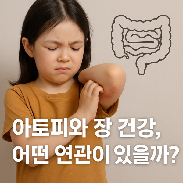아토피와 장 건강의 관련/gpt