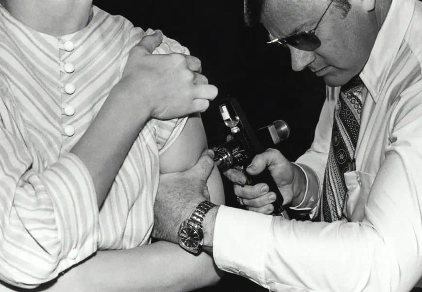 대상포진 치료의 모습