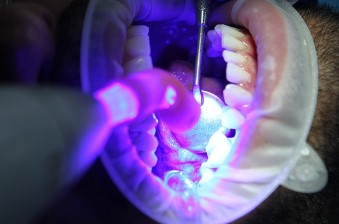 아침 입냄새 심한 이유와 해결법|잠에서 깼을 때 입 냄새 없애는 꿀팁