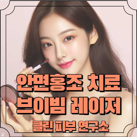 안면홍조 치료방법 (브이빔 레이저) 알아보기