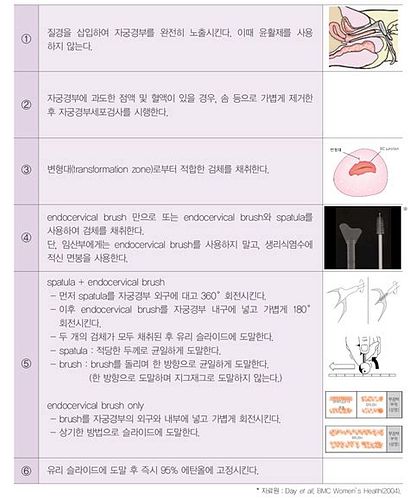 자궁경부조직검사