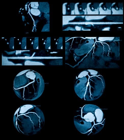 위조영술 (Barium Swallow): 위장관 이상을 확인하는 영상검사 가이드