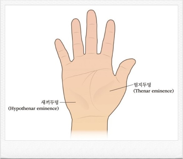 손 부위의 모습