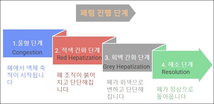 폐렴이 진행하는 단계