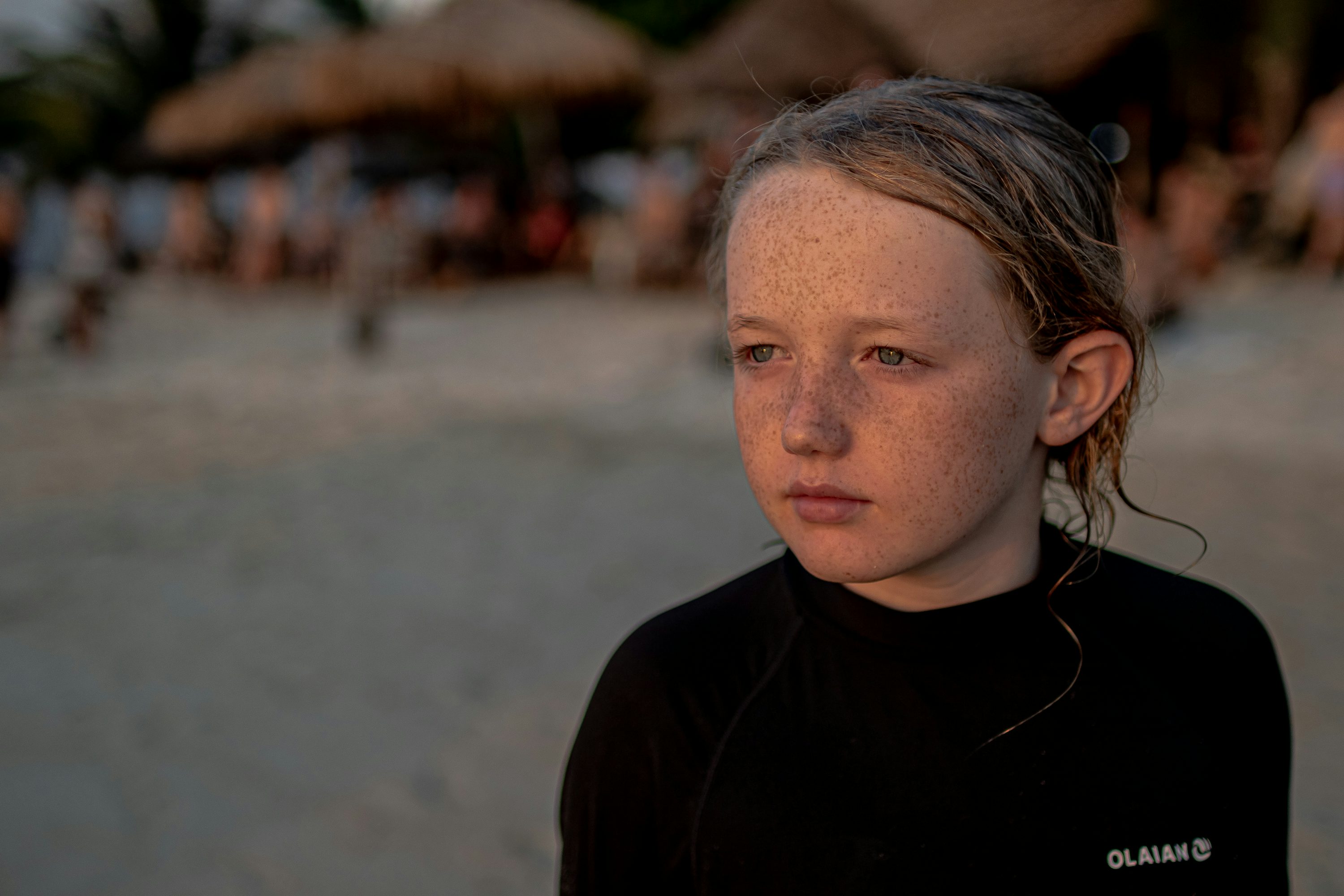 기미 잡티 완벽 제거법