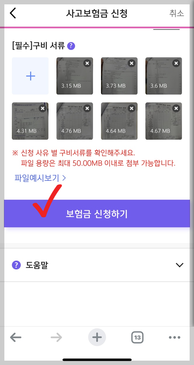 신한라이프치아보험금청구