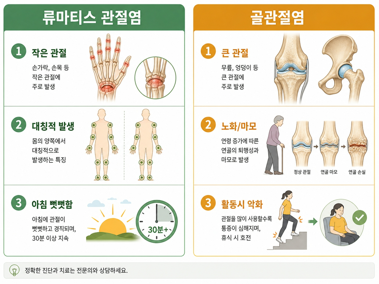관절염 종류 구별법 류마티스 골관절염 증상 차이