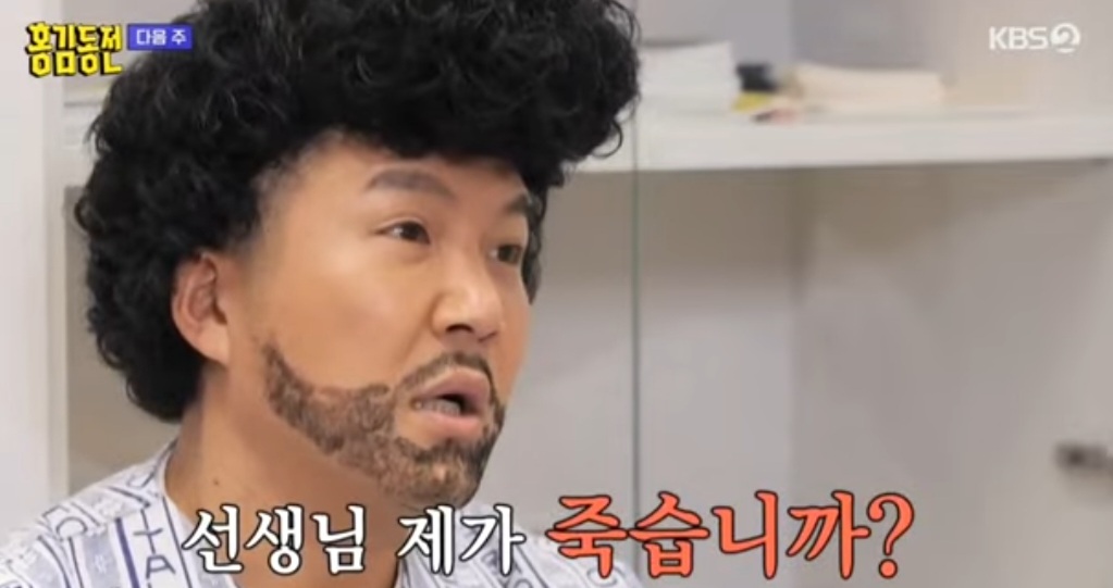 조세호 탈모
