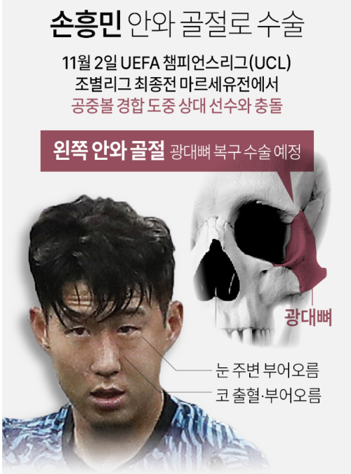 손흥민 수술 확정 안와골절 월드컵