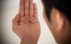 탈모 개선 방법