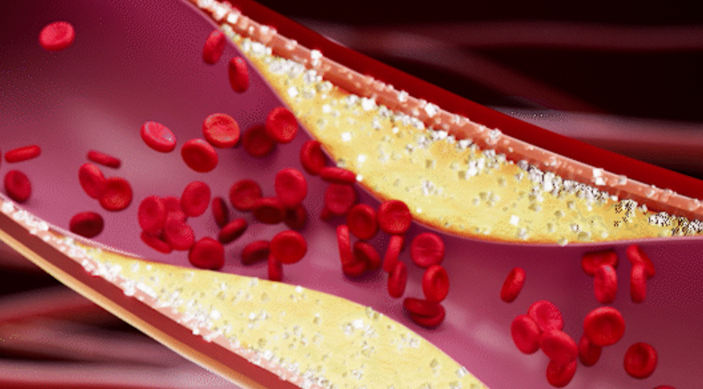 솔티스 혈당 프로텍션 프로 후기