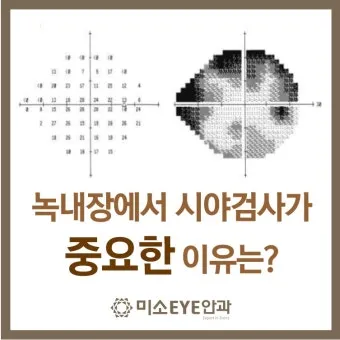 녹내장 진단 검사 비용 안압 검사주기 관리법_13
