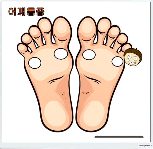 발바닥파스_붙이는위치_어깨통증