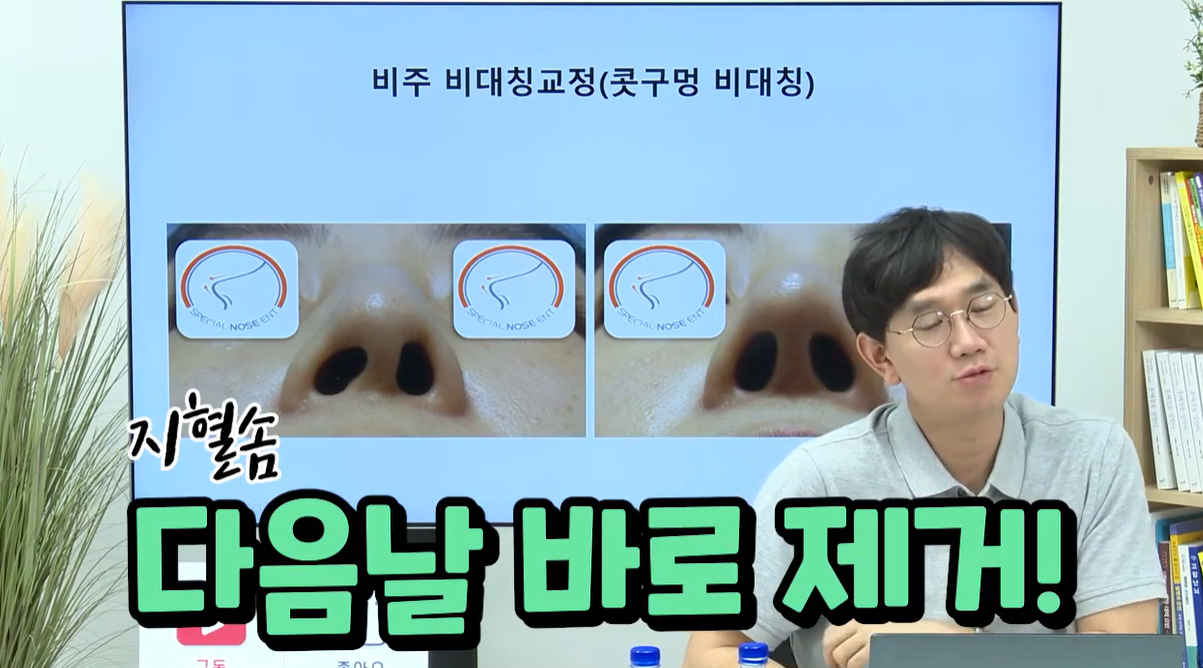 지혈솜 다음날 바로 제거