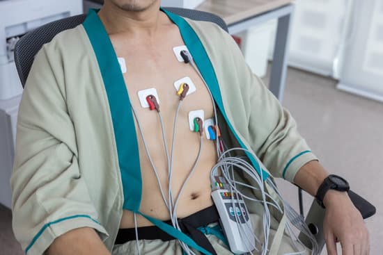 심전도(EKG, Electrocardiogram)