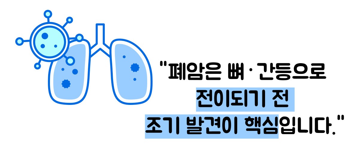 폐암 초기증상