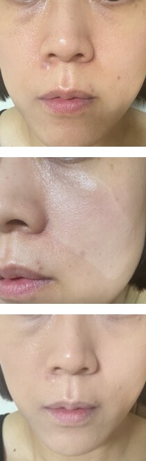 바르기전-볼쪽바름-바른후