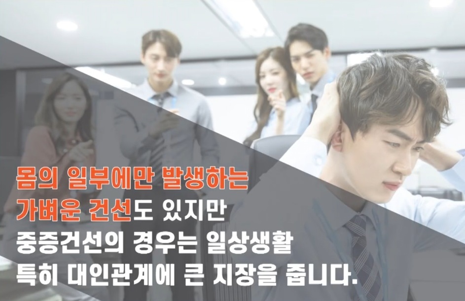 EBS명의-피부-명의-최용범-교수-대상포진-건선