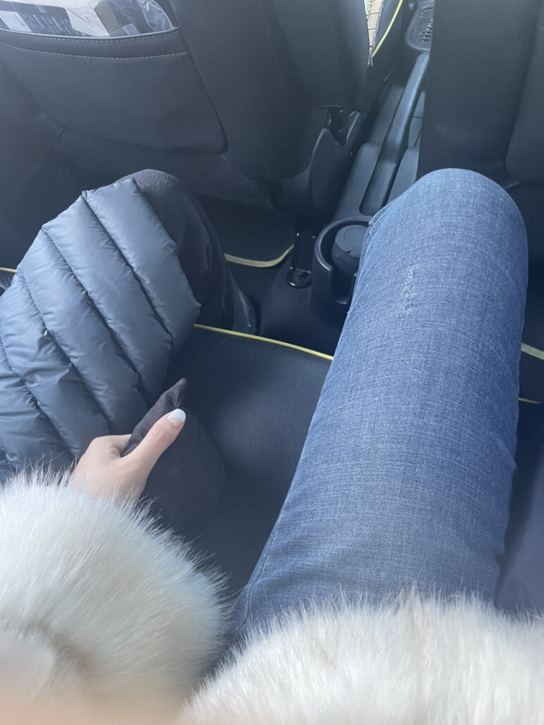 허벅지 지방흡입 후기