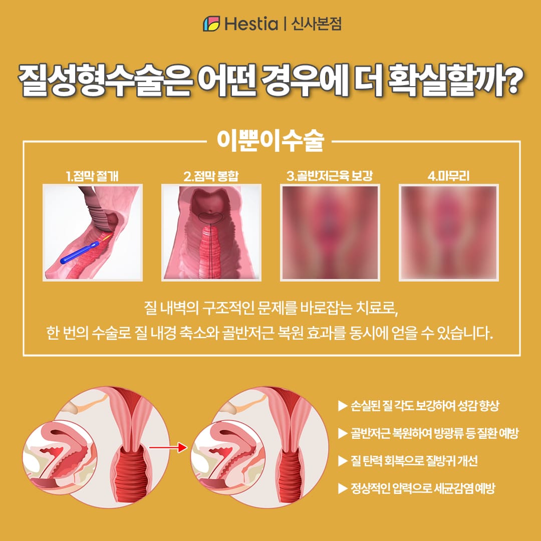 질성형수술은 어떤 경우에 더 확실할까?