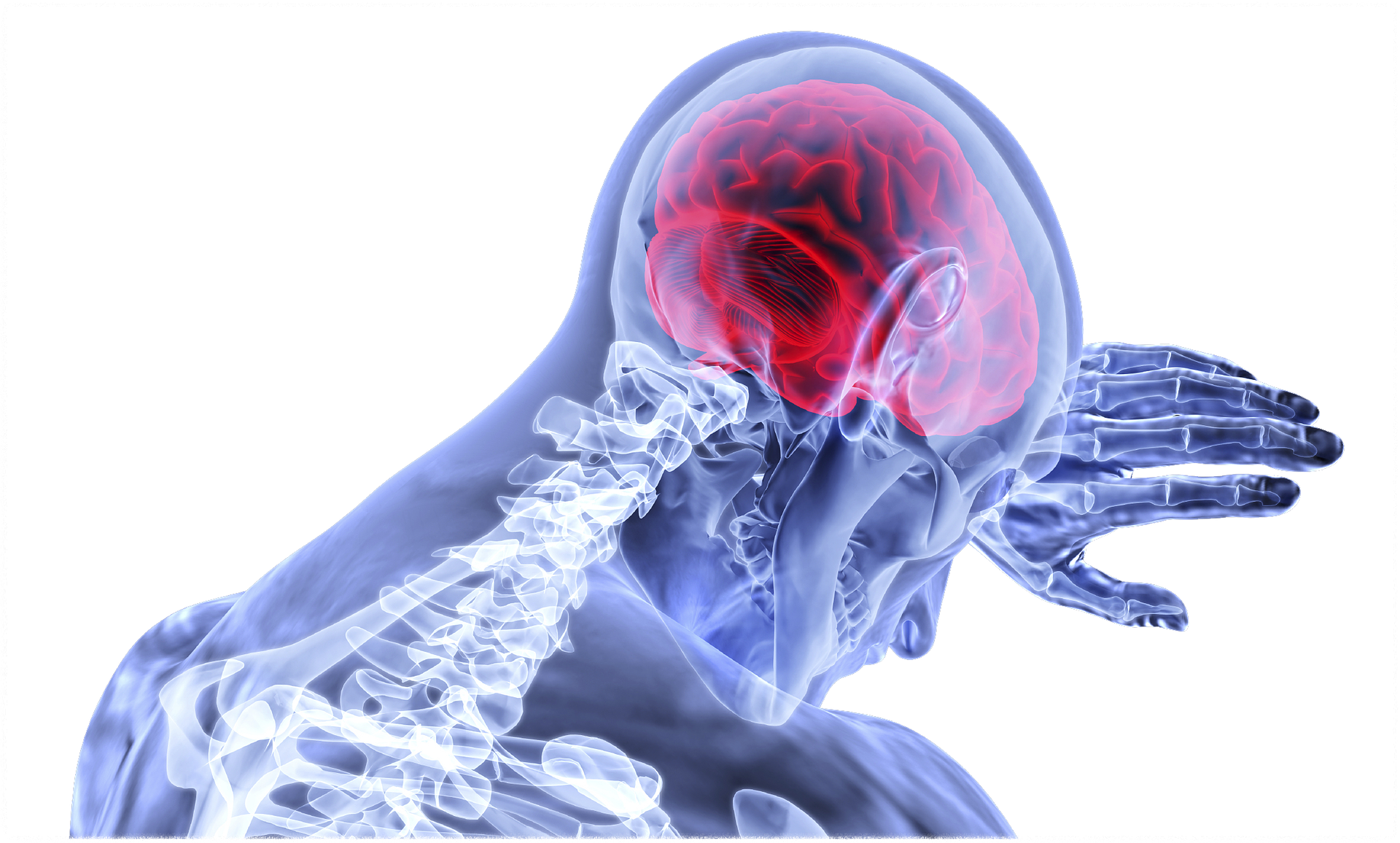 뇌경색 초기증상