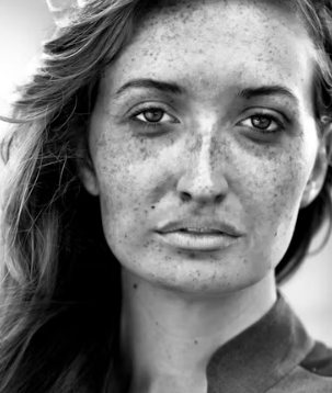 피부질환 종류 연고 종류 이유