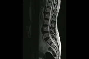 MRI-비용