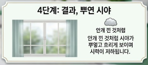 백내장 증상