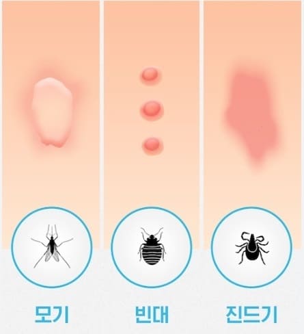 벌레별 물린 자국 비교