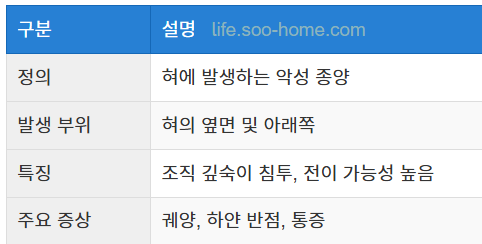 설암의 정의