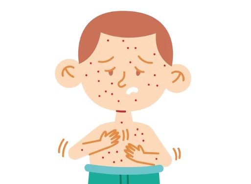 대상포진-초기-증상-합병증-6