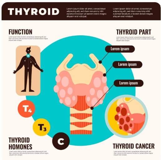 갑상선암 초기증상