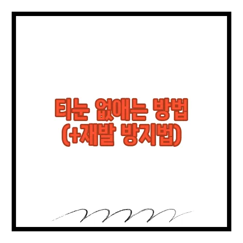 티눈 없애는 방법 (+재발 방지법)