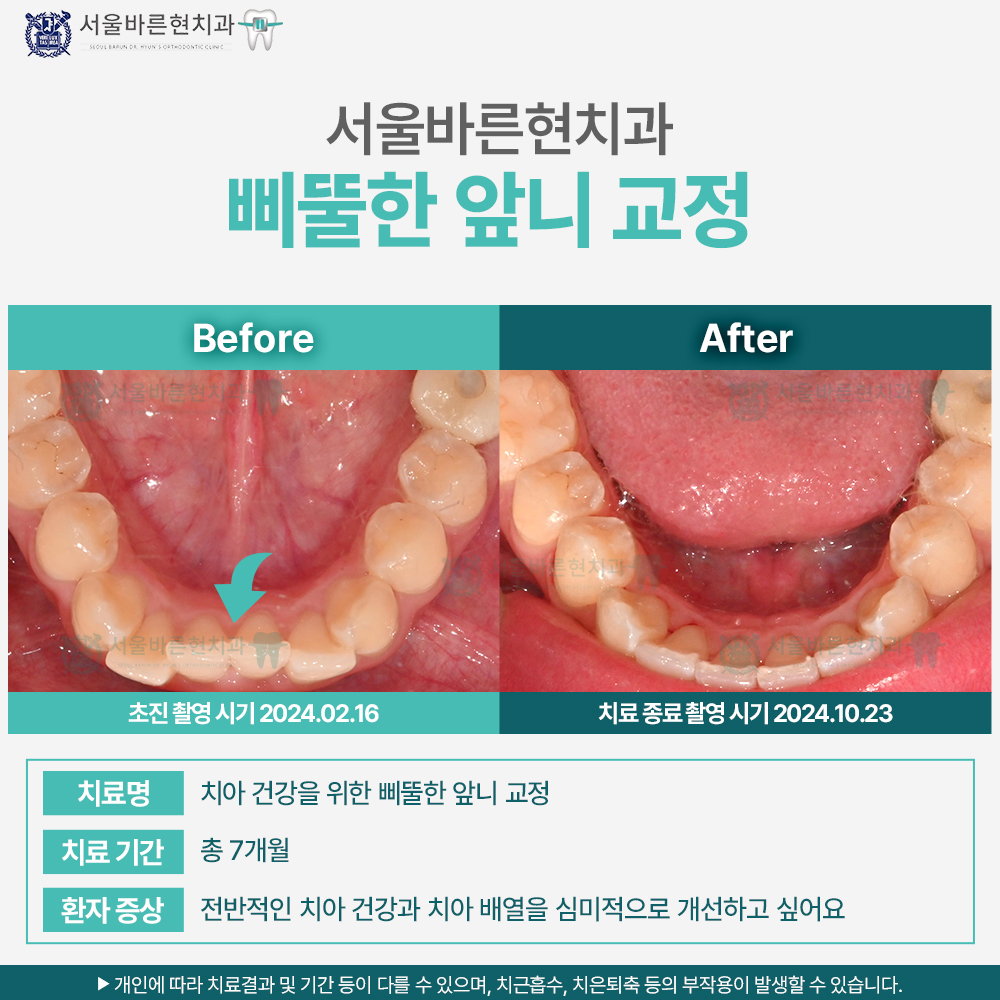 해운대교정치과