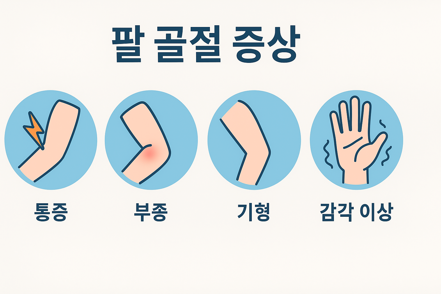 팔 골절 증상을 나타내는 인포그래픽 – 통증, 부종, 기형, 감각 이상을 아이콘으로 설명