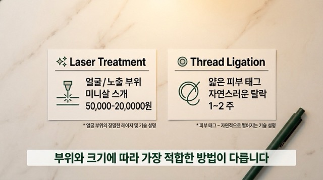 쥐젖 레이저 치료 실 결찰술 피부과 시술 상세 설명 이미지"