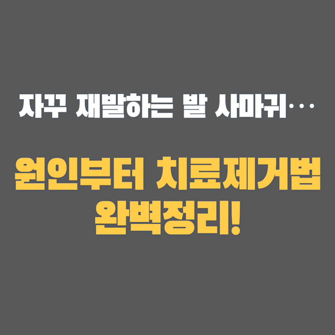 발 사마귀 치료 제거법 완벽정리! ㅣ원인부터 제거법까지