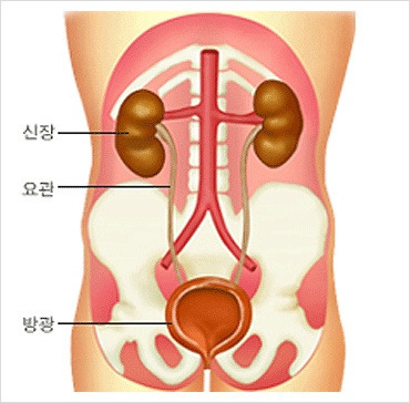 방광이 안좋을때 증상, 방광이 아파요 방광이 뻐근해요