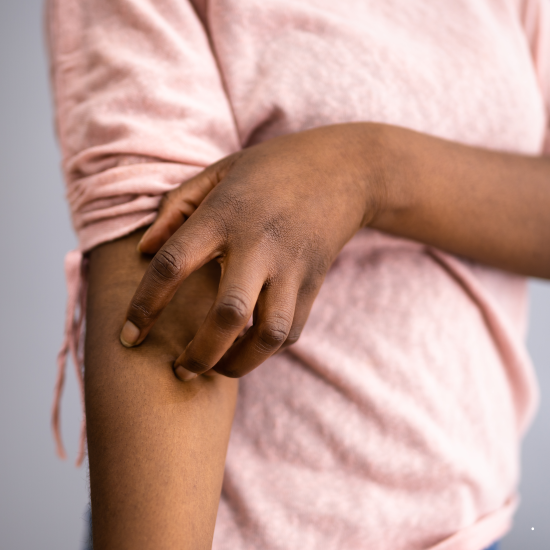 건선, 평생을 함께하는 만성 염증 질환