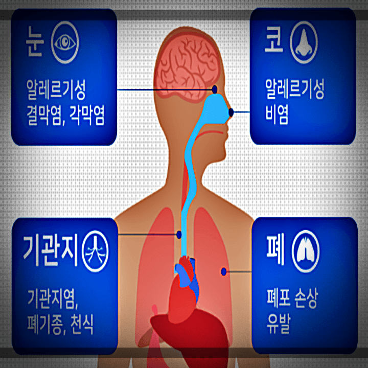 미세먼지-부위별-증상