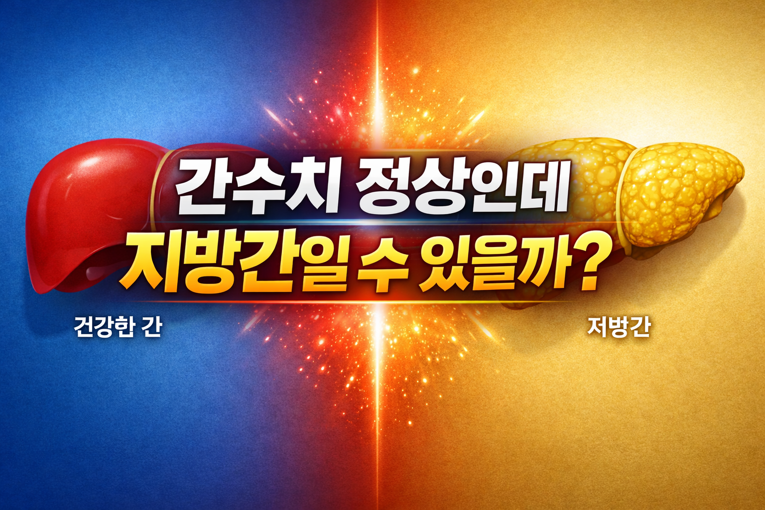 간수치 정상인데 지방간일 수 있을까?