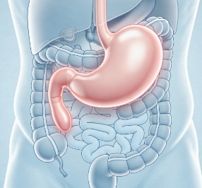 과민성 대장증후군 증상