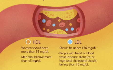 hdl ldl